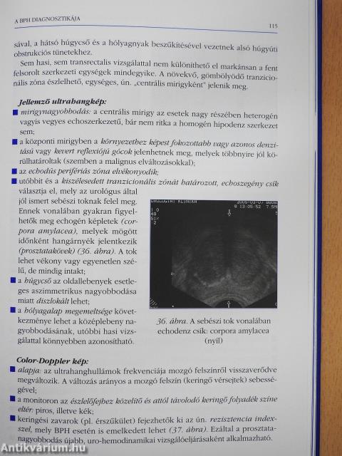 A prosztata betegségei (dedikált példány)