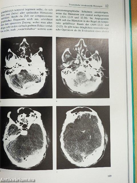 Traumatologie des Hirn- und Gesichtsschädels