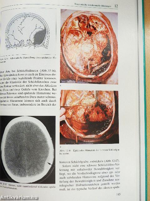 Traumatologie des Hirn- und Gesichtsschädels