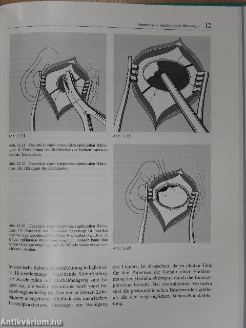 Traumatologie des Hirn- und Gesichtsschädels