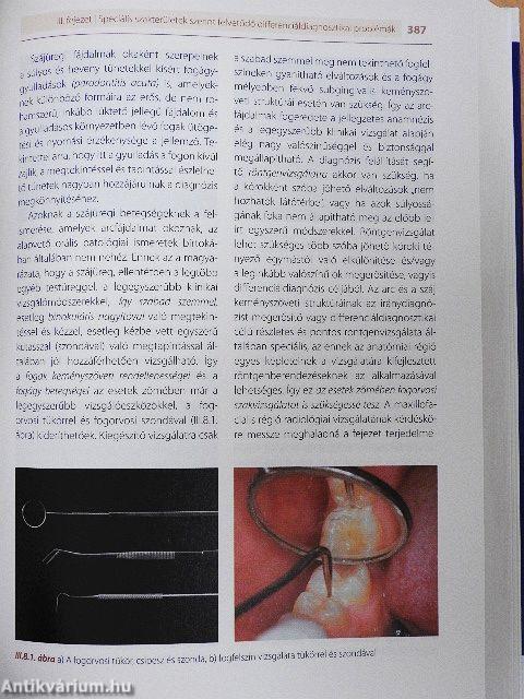 Differenciáldiagnosztikai kalauz