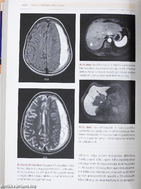Differenciáldiagnosztikai kalauz