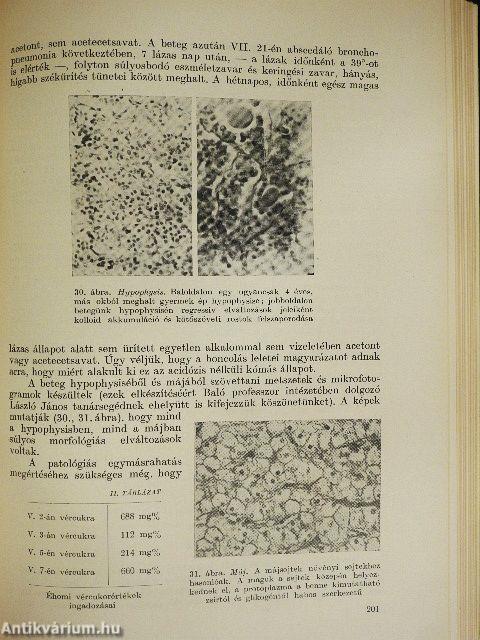Diabetes mellitus csecsemő- és gyermekkorban
