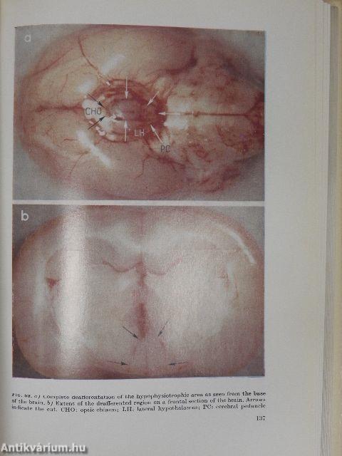 Hypothalamic Control of the Anterior Pituitary