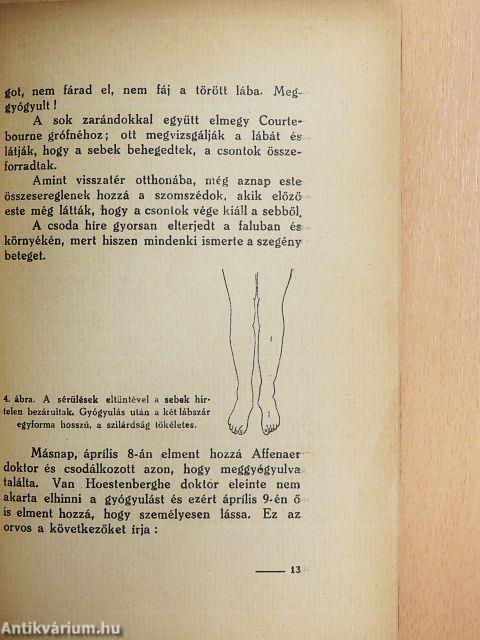 Lourdes-i gyógyulások