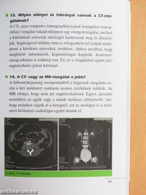 Urológiai betegségek