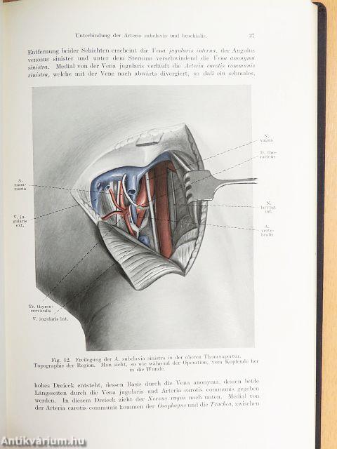 Topographische Anatomie Dringlicher Operationen