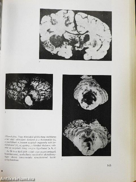 A klinikai neurologia alapjai