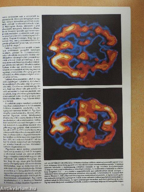 Tudomány 1985. szeptember-december 