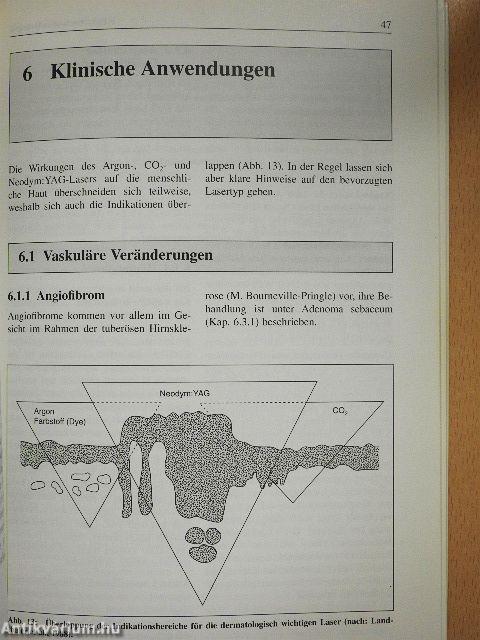 Dermatologische Lasertherapie