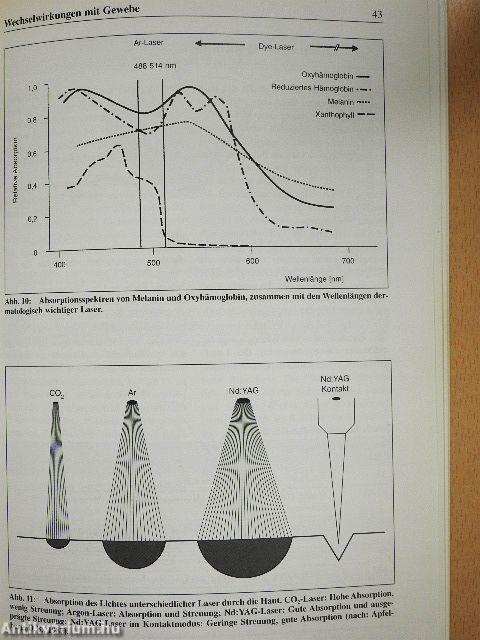 Dermatologische Lasertherapie