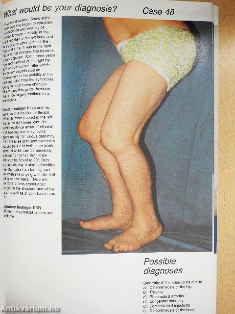 What would be your diagnosis?