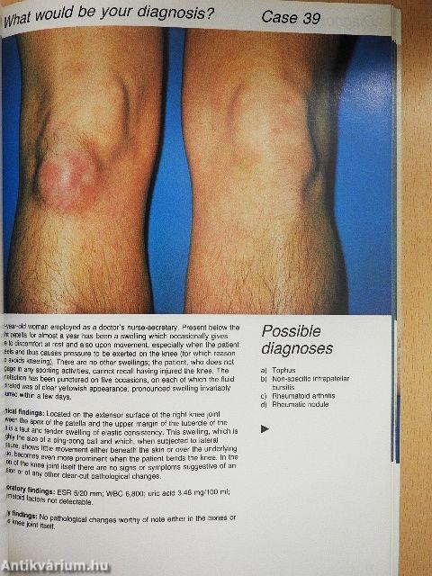 What would be your diagnosis?