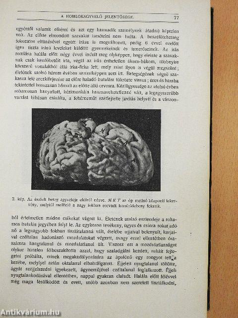 Természettudományi Közlöny 1916. január-deczember/Pótfüzetek a Természettudományi Közlönyhöz 1916. (nem teljes évfolyam)