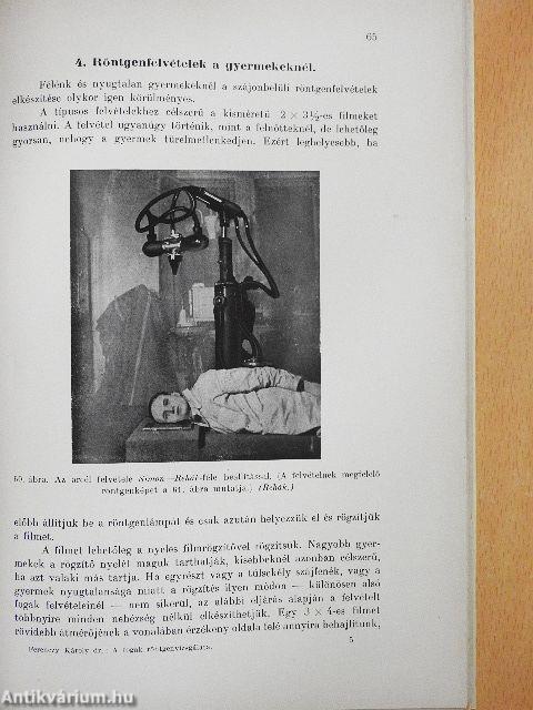 A fogak röntgenvizsgálata