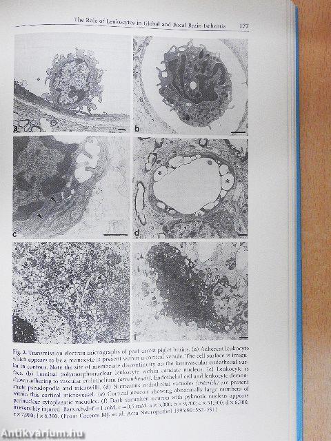 Intensive Care in Childhood