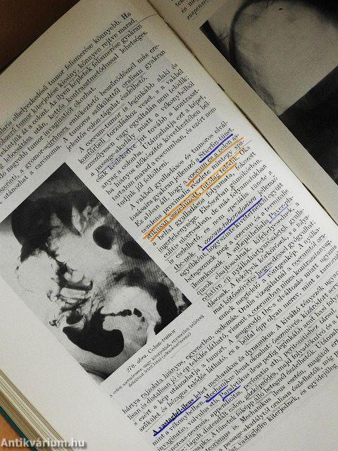 A radiologia alapvonalai