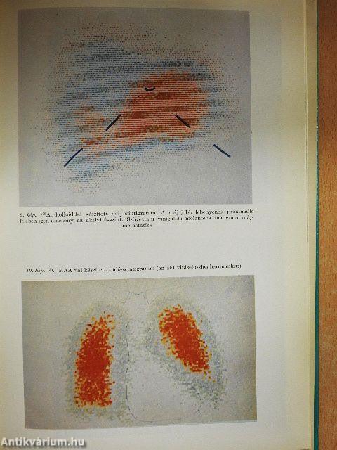 A radiologia alapvonalai