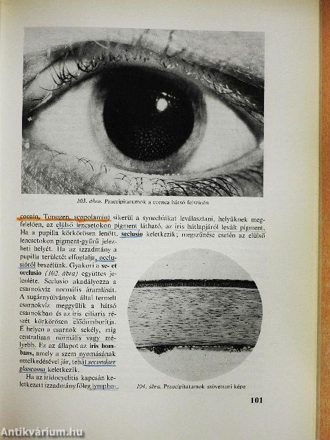 A szemészet alapvonalai 