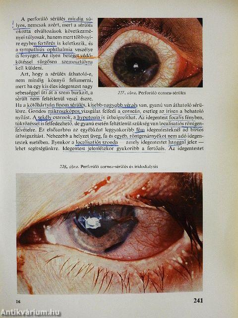 A szemészet alapvonalai 