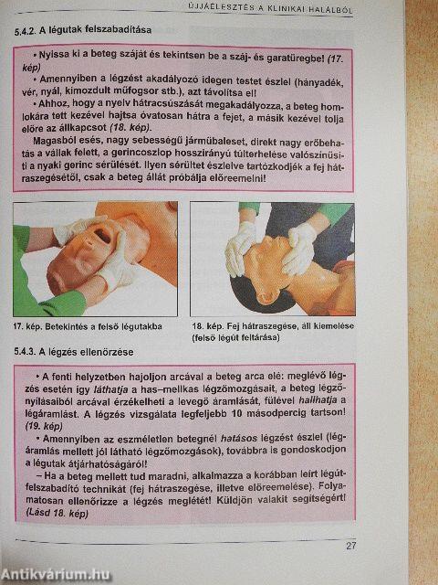 Elsősegély közúton, otthon, munkahelyen, közterületen