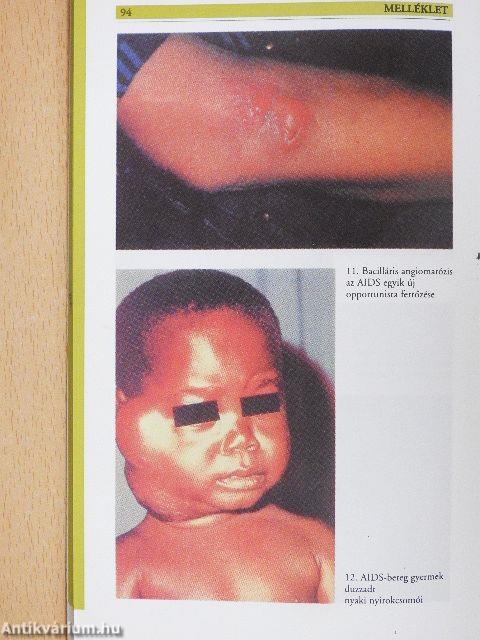 Korunk réme, az AIDS