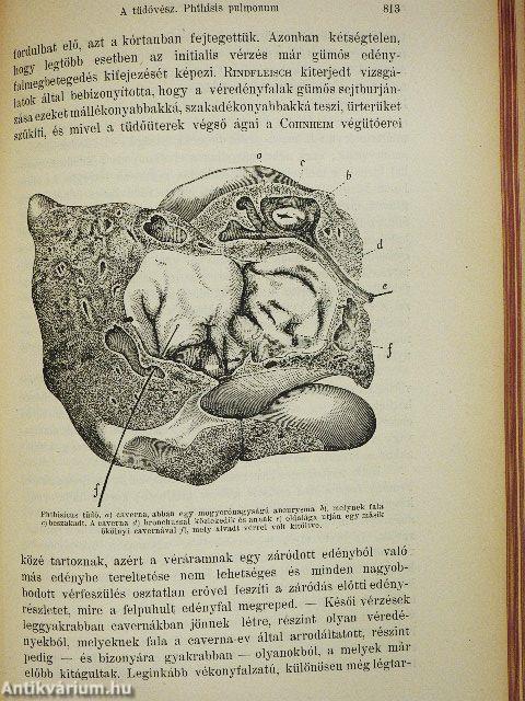 A belgyógyászat kézikönyve IV.