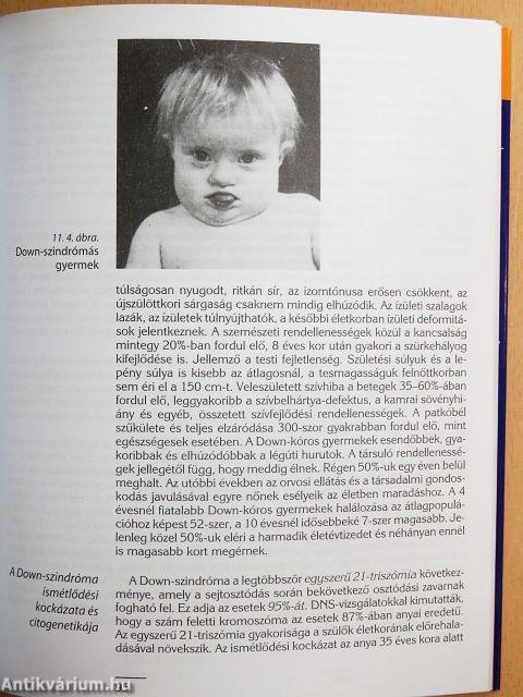 Genetikai tanácsok gyermeket váró szülőknek