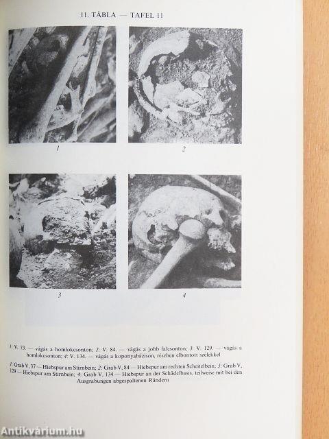 Az 1526-os mohácsi csata 1976-ban feltárt tömegsírjainak embertani vizsgálata