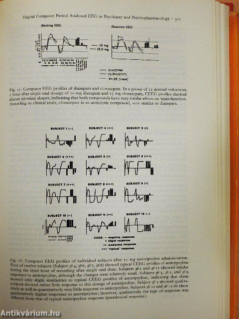 CEAN Computerized EEG Analysis