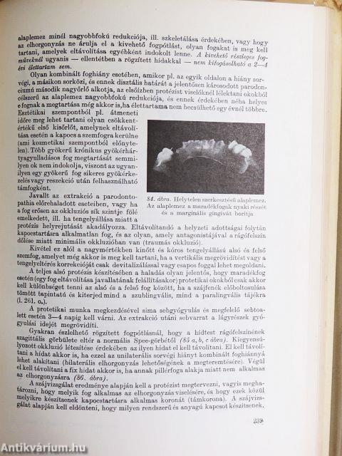 Hibák a fogorvosi gyakorlatban