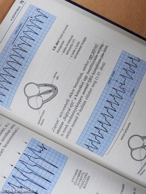 Az EKG helyes értelmezése