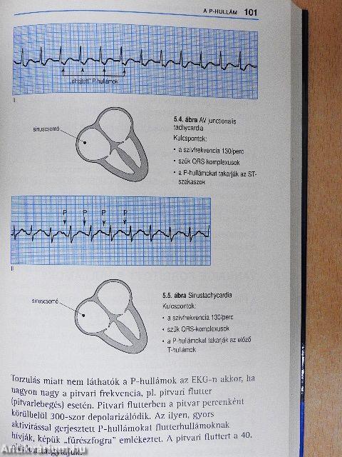 Az EKG helyes értelmezése