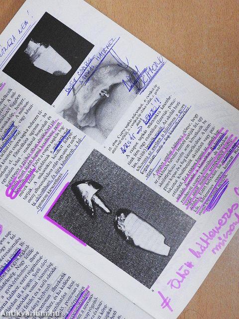 Klinikai fogpótlástan