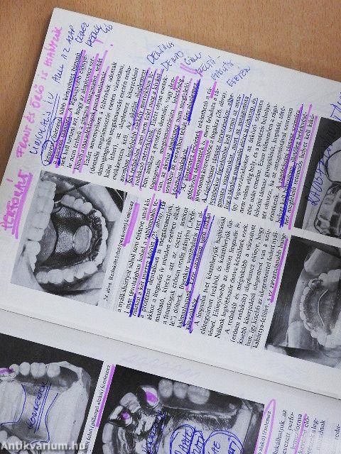 Klinikai fogpótlástan