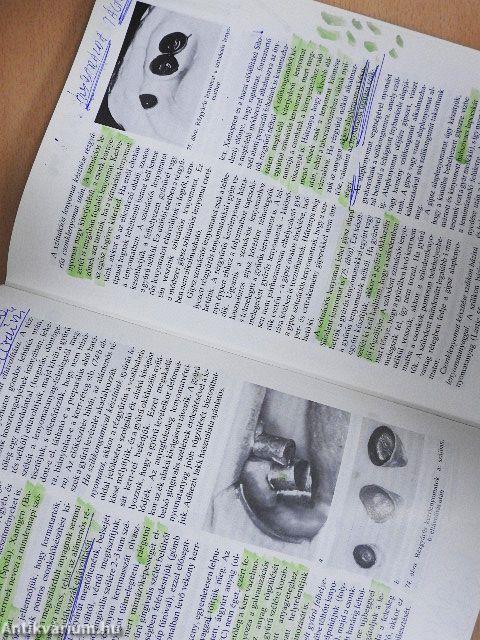 Klinikai fogpótlástan