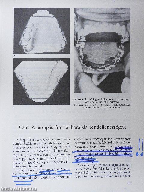Klinikai fogpótlástan