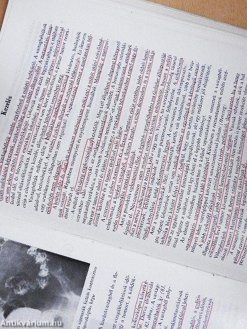 A daganatok sebészete