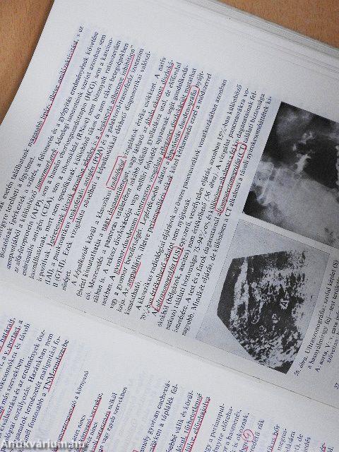 A daganatok sebészete