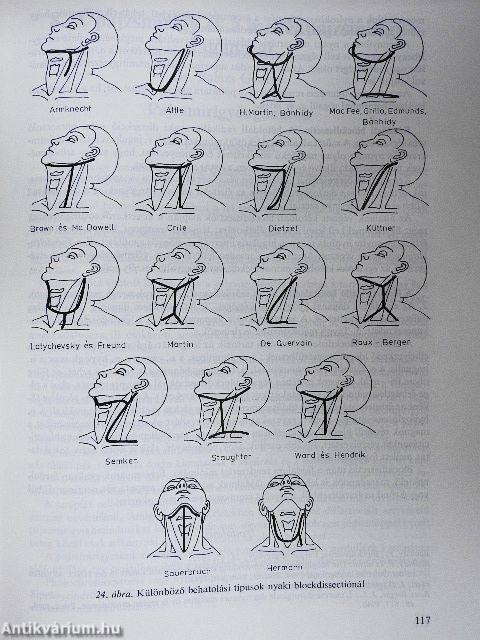 A daganatok sebészete