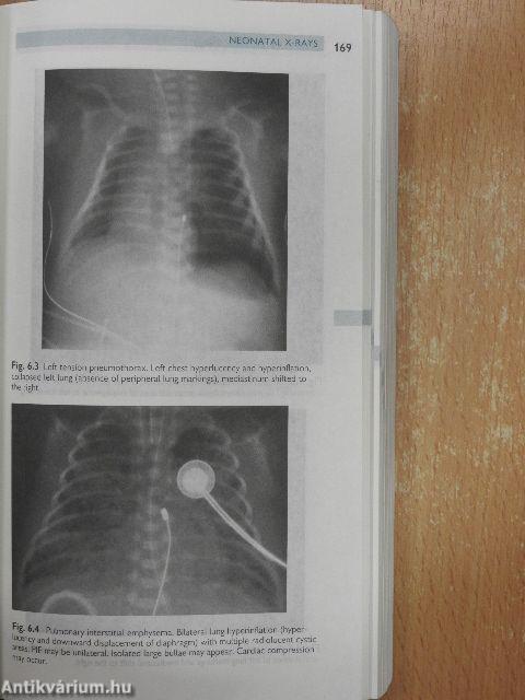 Oxford Handbook of Paediatrics