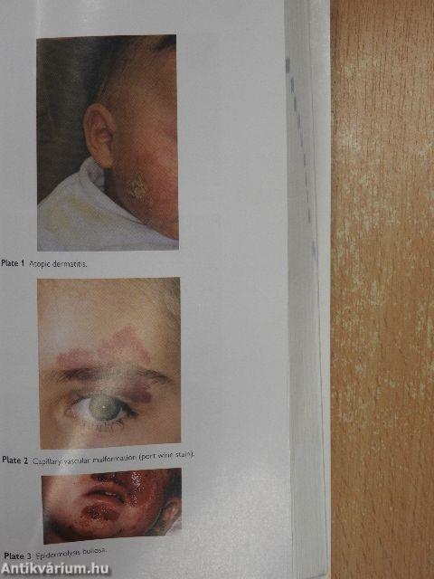 Oxford Handbook of Paediatrics