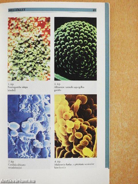 Gombás megbetegedések