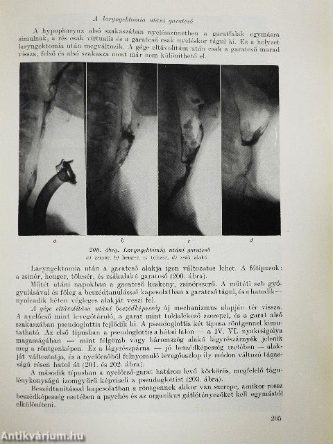 Orr-, fül-, gégészeti röntgendiagnosztika 