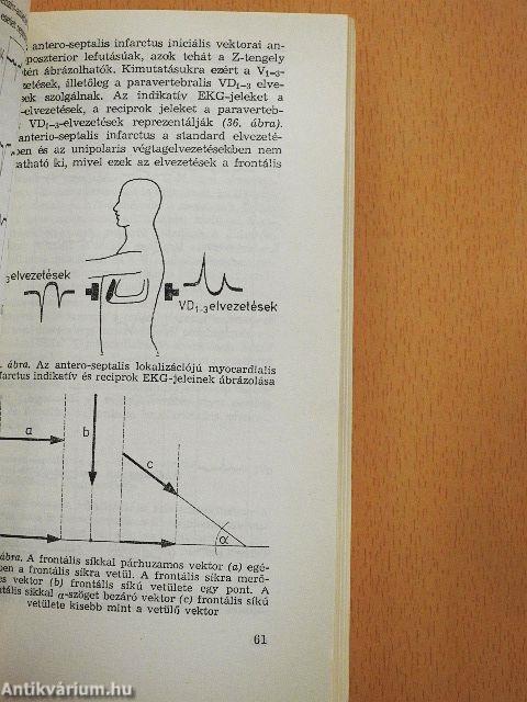 Gyakorlati elektrokardiográfia