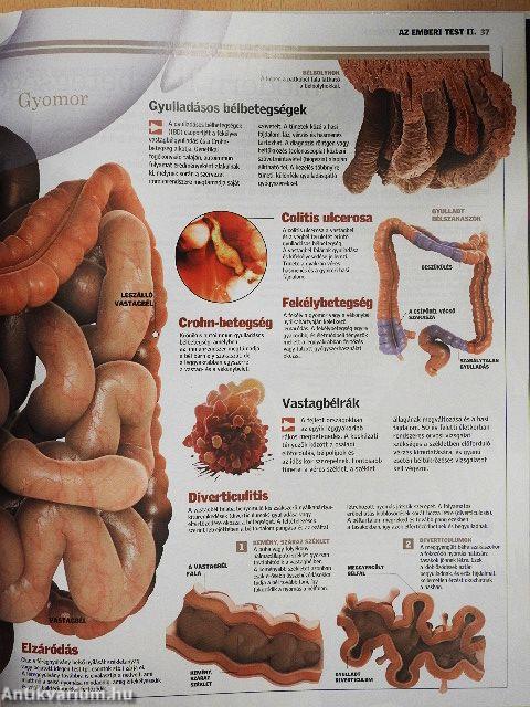 Gyógyítás és betegség