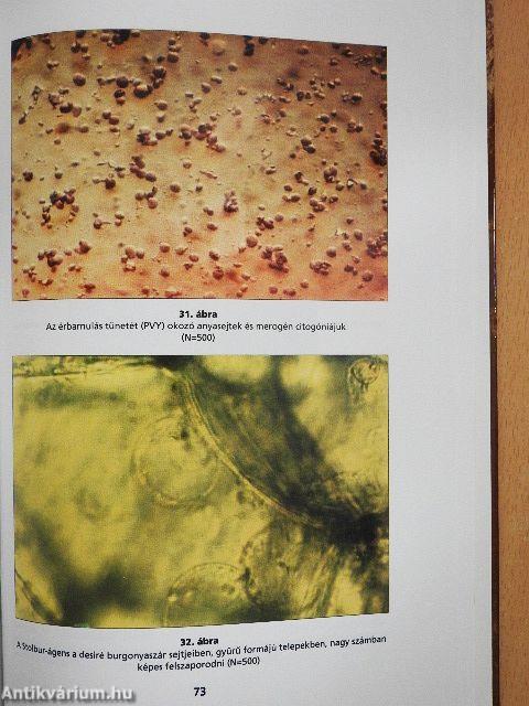 A burgonya levélsodródás és a dohány érbarnulás betegsége