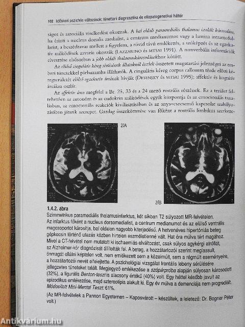 Kortünet vagy kórtünet?