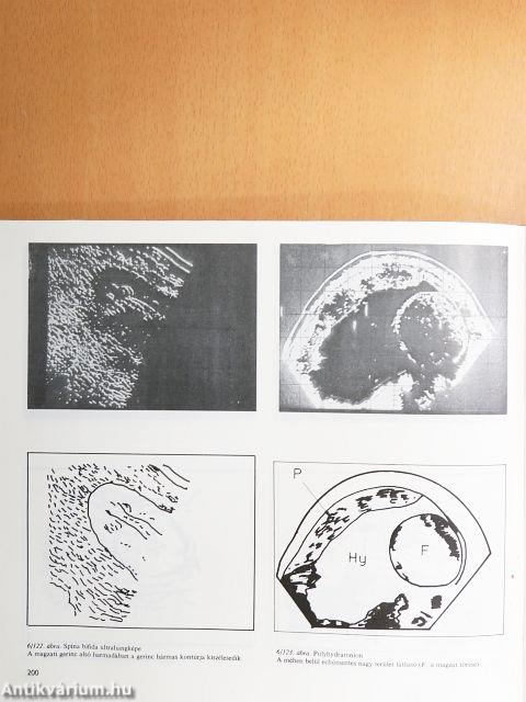 Szülészet-nőgyógyászat 1-3.