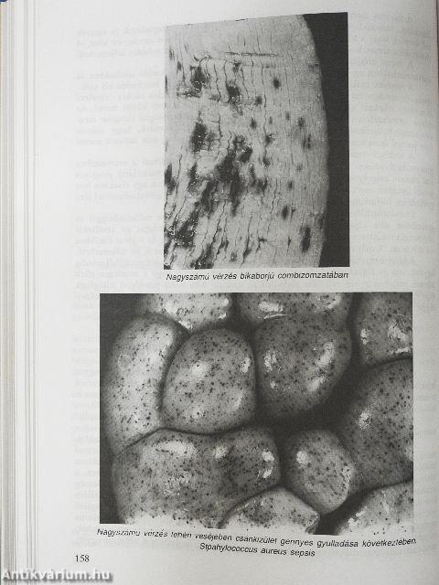 Élelmiszer-higiénia